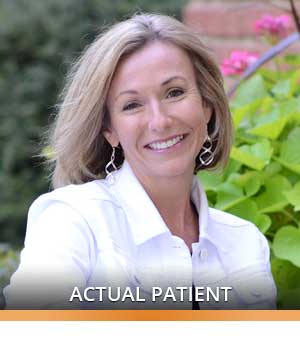 Invisalign Info Heather Longmont Orthodontics Longmont CO